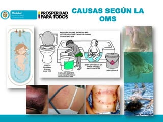 CAUSAS SEGÚN LA
OMS

 