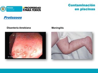 Contaminación
en piscinas

Protozoos
Disentería Amebiana

Meningitis

 