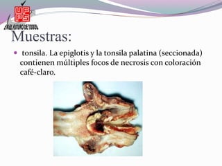Muestras:
 tonsila. La epiglotis y la tonsila palatina (seccionada)
contienen múltiples focos de necrosis con coloración
café-claro.
 