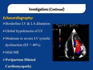 global hypokinesia of lv