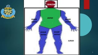 4
SHAJJAH
JURAH
JAIFAH
GHAIR
JAIFAH
GHAIR
JAIFAH
GHAIR
JAIFAH
GHAIR
JAIFAH
 