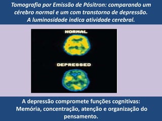 A depressão compromete funções cognitivas:
Memória, concentração, atenção e organização do
pensamento.
Tomografia por Emissão de Pósitron: comparando um
cérebro normal e um com transtorno de depressão.
A luminosidade indica atividade cerebral.
 