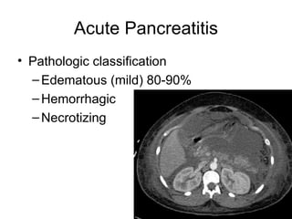 Acute Pancreatitis Pathologic classification Edematous (mild) 80-90% Hemorrhagic Necrotizing 
