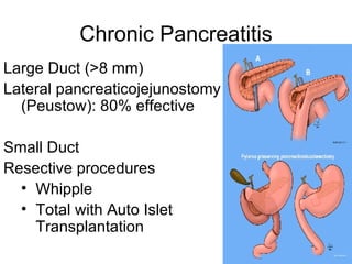 Chronic Pancreatitis Large Duct (>8 mm) Lateral pancreaticojejunostomy (Peustow): 80% effective Small Duct Resective procedures Whipple Total with Auto Islet Transplantation 
