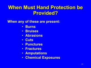 When Must Hand Protection be Provided? Burns Bruises Abrasions Cuts Punctures Fractures Amputations Chemical Exposures When any of these are present: 