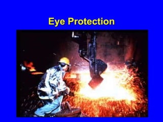 Eye Protection
 