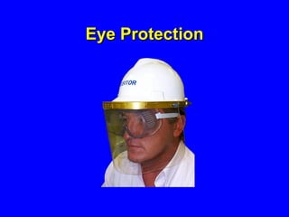 Eye Protection 
