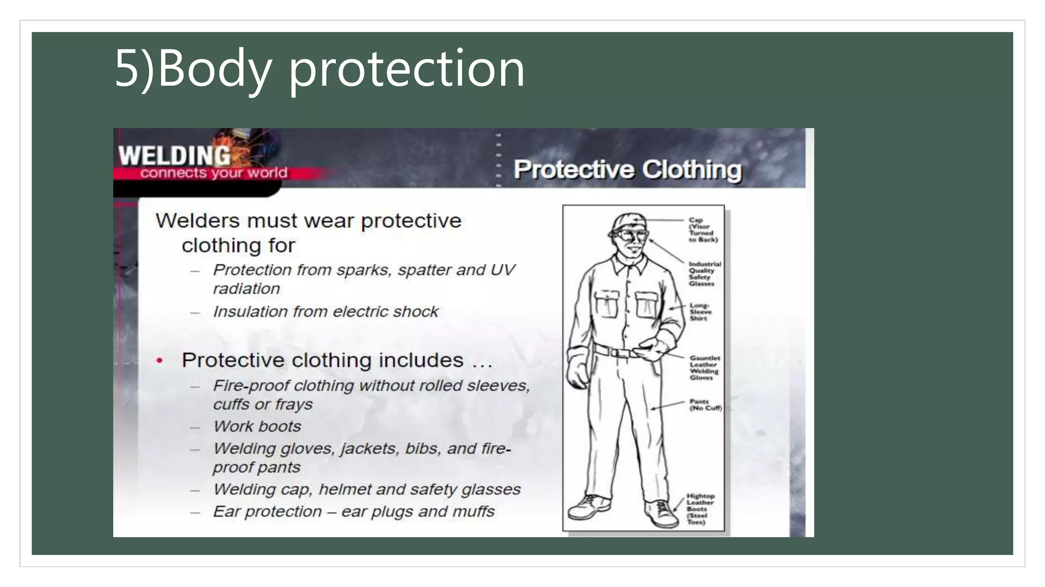 PPE for welders PPTX Eye and Vision Conditions Diseases and