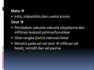 Mata 
 Iritis, iridosiklitis dan uveitis kronis
Otot 
 Perubahan vakuola-vakuola sitoplasma dan
infiltrasi leukosit polimorfonuklear
 Otot rangka (betis) nekrosis fokal
 Miositis pada sel-sel otot  infiltrasi sel
hiosit, netrofil dan sel pasma
21
 