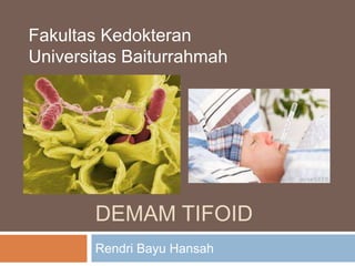 DEMAM TIFOID
Rendri Bayu Hansah
Fakultas Kedokteran
Universitas Baiturrahmah
 