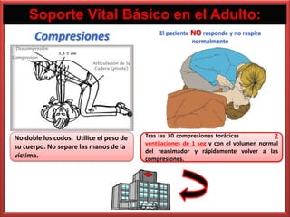 Soporte Vital Básico en el Adulto:
                                              El paciente NO responde y no respira
      Compresiones                                        normalmente




No doble los codos. Utilice el peso de   Tras las 30 compresiones torácicas          2
                                         ventilaciones de 1 seg y con el volumen normal
su cuerpo. No separe las manos de la
                                         del reanimador y rápidamente volver a las
víctima.                                 compresiones.
 