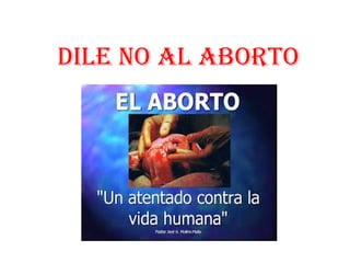 dile no al aborto
 