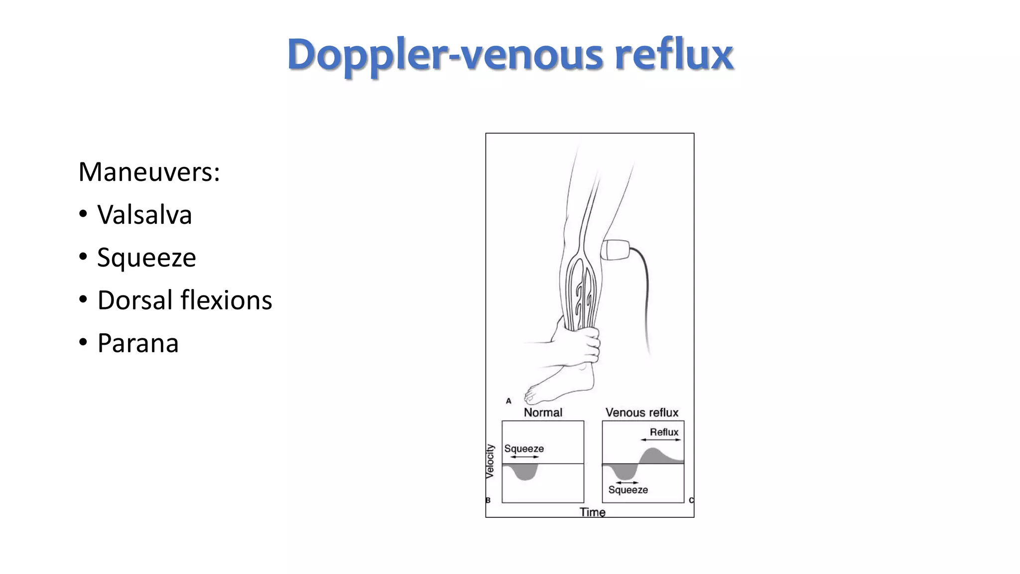 PPG and CDUS in venous reflux disease | PPTX