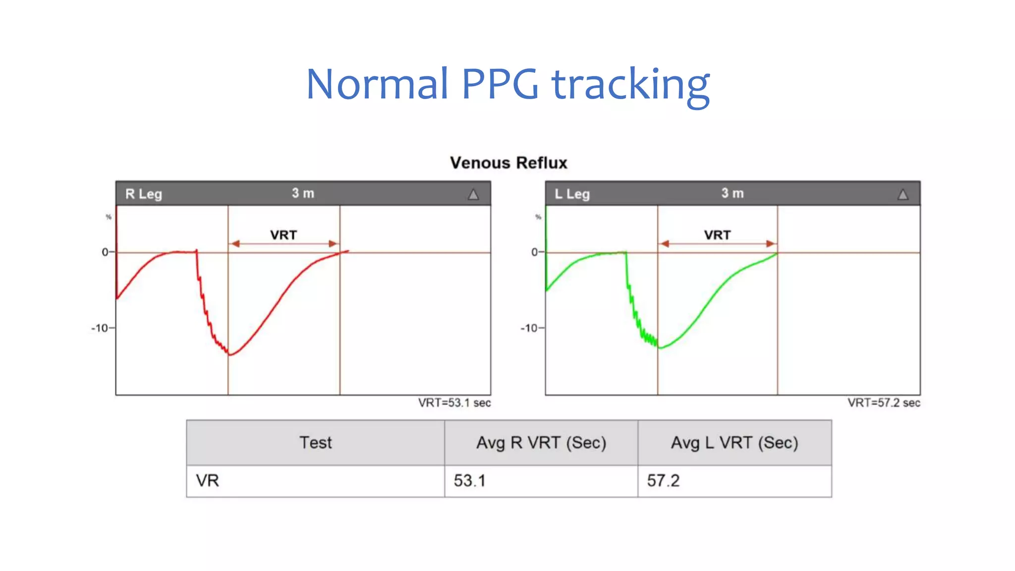 PPG and CDUS in venous reflux disease | PPTX