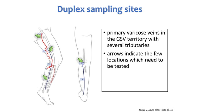 PPG and CDUS in venous reflux disease | PPTX