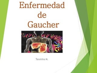 Enfermedad
de
Gaucher
Tanaisha M.
 