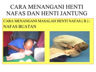 CARA MENANGANI HENTI NAFAS DAN HENTI JANTUNG CARA MENANGANI MASALAH HENTI NAFAS ( B ) : NAFAS BUATAN 