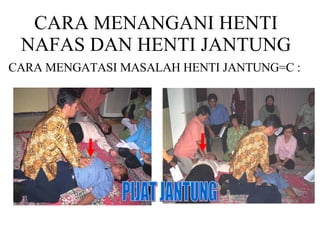 CARA MENANGANI HENTI NAFAS DAN HENTI JANTUNG CARA MENGATASI MASALAH HENTI JANTUNG=C : PIJAT JANTUNG  