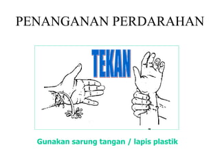PENANGANAN PERDARAHAN Gunakan sarung tangan / lapis plastik TEKAN 
