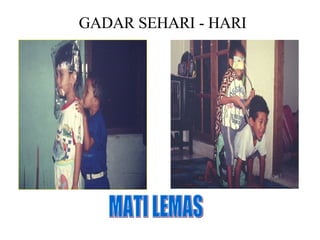 GADAR SEHARI - HARI MATI LEMAS 