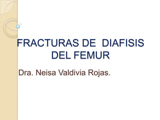 FRACTURAS DE  DIAFISIS  DEL FEMUR Dra. Neisa Valdivia Rojas. 