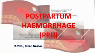 POSTPARTUM
HAEMORRHAGE
(PPH)
HAMDU, fahad Nassor.
 
