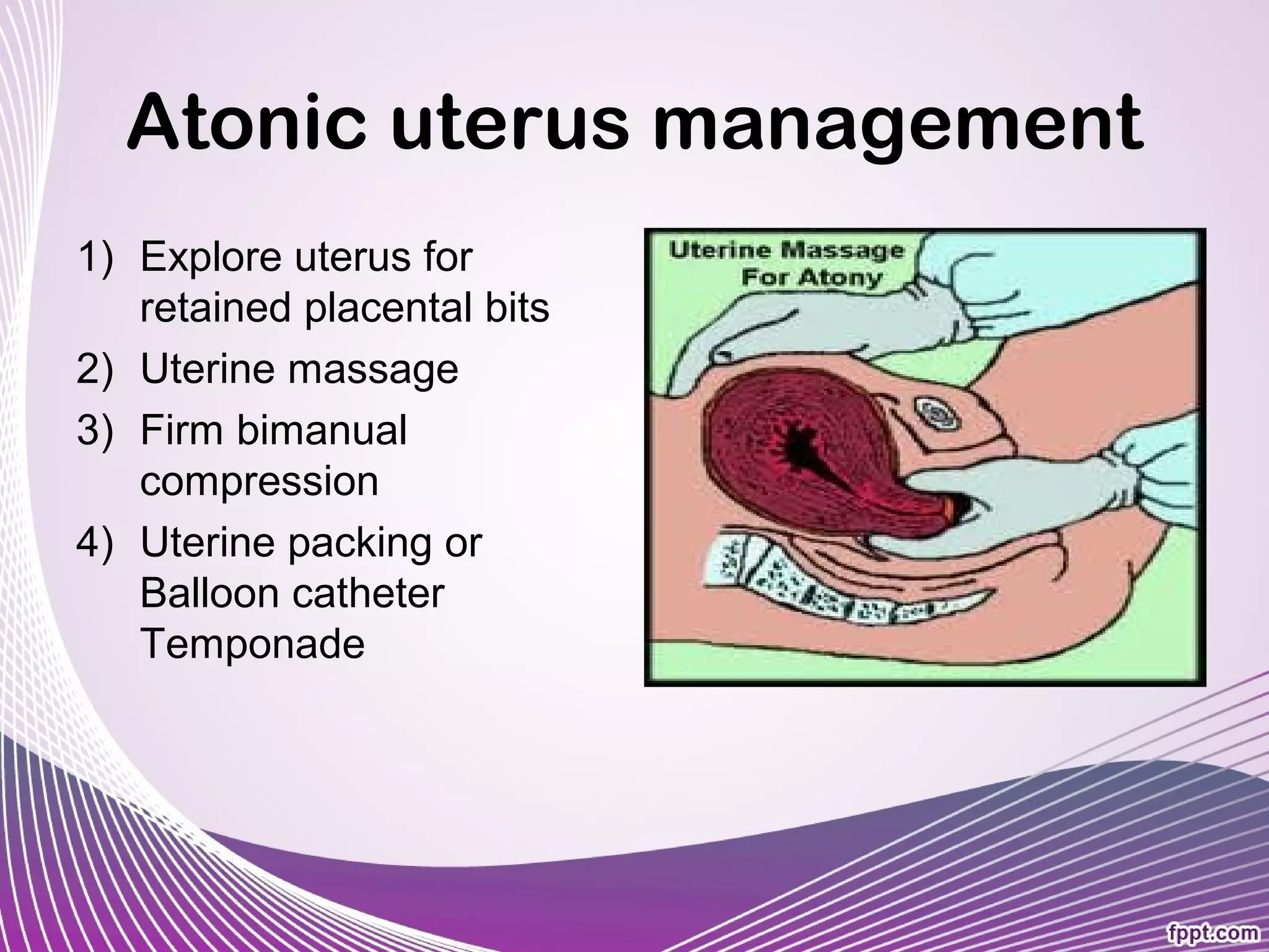 Post Partum Hemorrhage In ED PPT post-partum-hemorrhage-in-ed-ppt