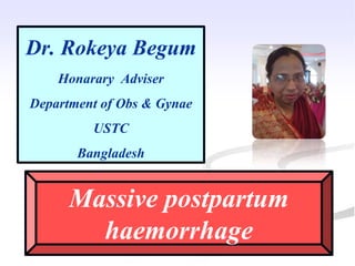 Dr. Rokeya Begum
Honarary Adviser
Department of Obs & Gynae
USTC
Bangladesh
Massive postpartum
haemorrhage
 