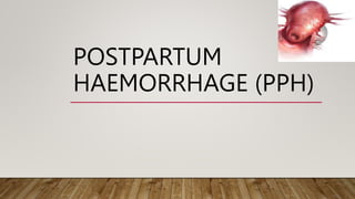 POSTPARTUM
HAEMORRHAGE (PPH)
 