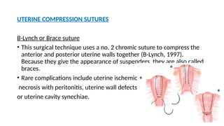 UTERINE COMPRESSION SUTURES
B-Lynch or Brace suture
• This surgical technique uses a no. 2 chromic suture to compress the
anterior and posterior uterine walls together (B-Lynch, 1997).
Because they give the appearance of suspenders, they are also called
braces.
• Rare complications include uterine ischemic
necrosis with peritonitis, uterine wall defects
or uterine cavity synechiae.
 