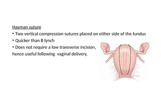 Hayman suture
• Two vertical compression sutures placed on either side of the fundus
• Quicker than B lynch
• Does not require a low transverse incision,
hence useful following vaginal delivery.
 