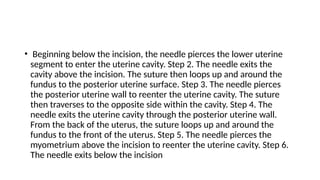 • Beginning below the incision, the needle pierces the lower uterine
segment to enter the uterine cavity. Step 2. The needle exits the
cavity above the incision. The suture then loops up and around the
fundus to the posterior uterine surface. Step 3. The needle pierces
the posterior uterine wall to reenter the uterine cavity. The suture
then traverses to the opposite side within the cavity. Step 4. The
needle exits the uterine cavity through the posterior uterine wall.
From the back of the uterus, the suture loops up and around the
fundus to the front of the uterus. Step 5. The needle pierces the
myometrium above the incision to reenter the uterine cavity. Step 6.
The needle exits below the incision
 