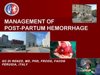 MANAGEMENT OF
 POST-PARTUM HEMORRHAGE




GC DI RENZO, MD, PHD, FRCOG, FACOG
PERUGIA, ITALY
 