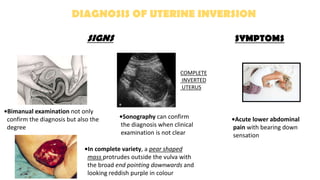 DIAGNOSIS OF UTERINE INVERSION
SIGNS SYMPTOMS
•Acute lower abdominal
pain with bearing down
sensation
•Bimanual examination not only
confirm the diagnosis but also the
degree
COMPLETE
INVERTED
UTERUS
•Sonography can confirm
the diagnosis when clinical
examination is not clear
•In complete variety, a pear shaped
mass protrudes outside the vulva with
the broad end pointing downwards and
looking reddish purple in colour
 