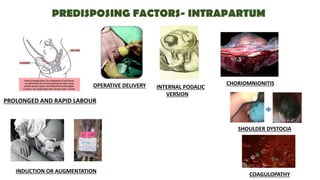 PREDISPOSING FACTORS- INTRAPARTUM
PROLONGED AND RAPID LABOUR
OPERATIVE DELIVERY INTERNAL PODALIC
VERSION
CHORIOMNIONITIS
SHOULDER DYSTOCIA
COAGULOPATHY
INDUCTION OR AUGMENTATION
 