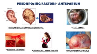 PREDISPOSING FACTORS- ANTEPARTUM
•ABRUPTIO PLACENTA/ PLACENTA PREVIA •FETAL DEMISE
•BLEEDING DISORDER •GESTATIONAL HYPERTENTION •OVER DISTENDED UTERUS
 