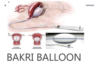 ****AVAILABLE IN DISTRICT*****
BAKRI BALLOON
 