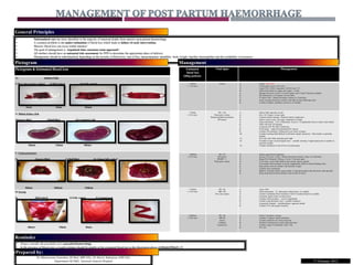 • Substandard care has been identified in the majority of maternal deaths from massive post partum haemorrhage.
• A common problem is the under-estimation of blood loss which leads to failure of early intervention.
• Massive blood loss can occur within minutes!
• The goal of management is ‘organized time conscious team approach’.
• All mothers should have an antenatal risk assessment for PPH to determine the appropriate place of delivery.
• Management should be individualized depending on the severity of blood loss, rate of loss, haemodynamic instability, body weight, baseline haemoglobin and the availability of resources.
• Active interventions in the “golden hour” is critical
Dr Muniswaran Ganeshan (M.Med, MRCOG), Dr Harris Suharjono (FRCOG)
Department Of O&G, Sarawak General Hospital
(
• Always consider the possibility of a concealed haemorrhage.
• In the presence of blood clots, a rough estimate should be double of the estimated blood lost in the illustration above (estimated blood x 2)
General Principles
Pictogram
Prepared by:
Reminder
Pictogram & Estimated Blood loss
A) Sanitary Pads
i) More then quarter soaked ii) Half soaked iii) Fully soaked
20mls 50mls 100mls
B) 500mls Kidney dish
i)Quarter filled ii)Half filled iii) Completely full
100mls 250mls 500mls
C ) Linen protectors
d) Quarter filled ii) Half filled iii) Almost fully soaked
500mls 1000mls 1500mls
D) Sarong
d) Half soaked ii) Fully soaked E) Vaginal pack
400mls 700mls 80mls
Estimated
blood loss
(60kg patient)
Vital signs Management
> 500mls
(< 15% loss)
Normal 1) Initiate “Red Alert”
2) 2 Intravenous access (14G /16G)
3) Urgent FBC, GXM, Coagulation, BUSE/Creat, LFT
4) Inform blood bank for urgent cross match – 4 units
5) Massage the uterus! Atony? Cervical/Vaginal tears? Check if placenta complete.
6) IM syntometrine or IV pitocin 5iu slow bolus
7) IV pitocin 40iu / 500mls Hartmanns solution at 125mls/hour
8) Assess on going blood loss, monitor vital signs & treat underlying cause.
9) In district hospital: ambulance and driver on standby!
>750mls
(<35% loss)
PR> 100
Weak pulse volume
Reduced peripheral perfusion
BP normal
1) Inform O&G specialist on-call
2) Give 15L Oxygen via face mask
3) Continue uterine massage / bimanual uterine compression
4) Staff to record events, vital signs, medications & fluids.
5) Fluid resuscitation – 2.0L of Hartmanns & up to 1.5L gelafundin/voluven (infuse warm fluids).
6) CBD, with strict I/O charting.
7) Continuous BP, PR, SPO2 monitoring.
8) If still atonic – repeat IM syntometrine/IV pitocin
9) Consider IM carboprost 250mcg stat or per rectal cervagem
10) Consider inserting Bakri Balloon if still atonic despite uterotonics. Then transfer to specialist
hospital.
11) EUA only after O&G specialist green light
12) If unable to repair cervical/vaginal tears – consider inserting 2 vaginal packs prior to transfer to
specialist hospital
13) Consider transfusion if rate of loss is not decreasing
>1000mls
(<35% loss)
PR>110
BP normal
PR/SBP > 1
Weak pulse volume
1) Initiate urgent blood transfusion
2) Increase IV pitocin to 80iu / 500mls Hartmanns Solution, infuse at 125mls/hour.
3) Repeat IM Carboprost 250mcg x 4 every 15 minutes apart.
4) If still atonic, insert Bakri Balloon then transfer patient urgently
5) Can consider blood products & correct coagulopathy based on clinical findings alone
6) Keep patient warm & continue with facemask oxygen.
7) Continue close monitoring
8) Stabilize if possible before urgent transfer to specialist hospital after discussion with specialist.
9) Bring along blood & blood products and escorted by doctor
>1500mls
(> 35% loss)
PR>120
SBP<100
Poor urine output
1) Assess ABC
2) Fluid resuscitation – 2L Hartmanns solution then 1.5L colloids
3) Consider unmatched blood transfusion ASAP if matched blood not available.
4) Uterotonic agents if have not been given.
5) Transfuse blood products – correct coagulopathy
6) Transfer using the fastest route…(consider medevac)
7) In specialist hospitals – multidisciplinary approach needed
8) Consider EUA and surgical measures.
2000mls
(> 40% loss)
PR>140
SPB<80
Anuria
Confused
Unconscious
1) Inform Consultant in charge
2) Consider O negative blood transfusion.
3) Consider intubation for airway protection
4) Decide for hysterectomy sooner rather then later.
5) Consider usage of recombinant factor VIIa
6) ICU care
Management
1st February 2012
 