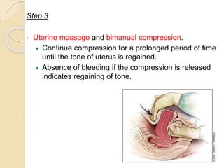 Post Partum Haemorrhage PPTX post-partum-haemorrhage-pptx