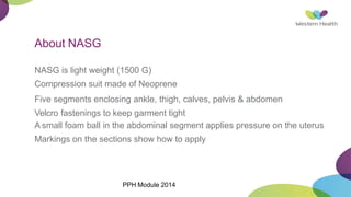 About NASG
NASG is light weight (1500 G)
Compression suit made of Neoprene
Five segments enclosing ankle, thigh, calves, pelvis & abdomen
Velcro fastenings to keep garment tight
A small foam ball in the abdominal segment applies pressure on the uterus
Markings on the sections show how to apply
PPH Module 2014
 