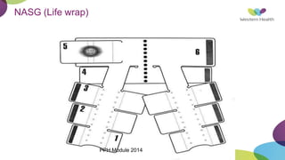 NASG (Life wrap)
PPH Module 2014
 