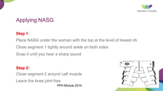 Applying NASG
Step 1:
Place NASG under the woman with the top at the level of lowest rib
Close segment 1 tightly around ankle on both sides
Snap it until you hear a sharp sound
Step 2:
Close segment 2 around calf muscle
Leave the knee joint free
PPH Module 2014
 