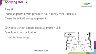 Applying NASG
Step 5:
Place segment 5 with pressure ball directly over umbilicus
Close the NSAG using segment 6
Only one person should close segment 4 & 5
Should not be too tight to
restrict breathing
PPH Module 2014
 