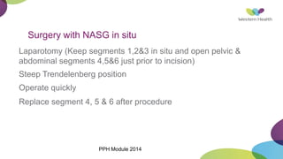 Surgery with NASG in situ
Laparotomy (Keep segments 1,2&3 in situ and open pelvic &
abdominal segments 4,5&6 just prior to incision)
Steep Trendelenberg position
Operate quickly
Replace segment 4, 5 & 6 after procedure
PPH Module 2014
 
