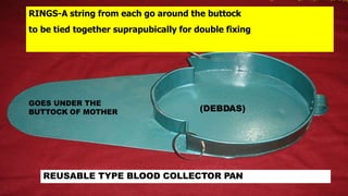 GOES UNDER THE
BUTTOCK OF MOTHER
RINGS-A string from each go around the buttock
to be tied together suprapubically for double fixing
REUSABLE TYPE BLOOD COLLECTOR PAN
(DEBDAS)
 