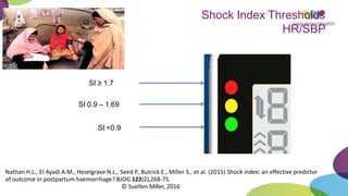 Shock Index Thresholds
HR/SBP
SI ≥ 1.7
SI 0.9 – 1.69
SI <0.9
Nathan H.L., El Ayadi A.M., Hezelgrave N.L., Seed P., Butrick E., Miller S., et al. (2015) Shock index: an effective predictor
of outcome in postpartum haemorrhage? BJOG 122(2),268-75.
© Suellen Miller, 2016
 