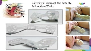 University of Liverpool: The Butterfly
Prof. Andrew Weeks
© Suellen Miller, 2016
 