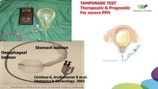 TAMPONADE TEST
Therapeutic & Prognostic
For severe PPH
Stomach balloon
Oesophageal
balloon
Condous G, Arulkumaran S et.al.
Obstetrics & Gynecology. 2003
 