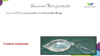 182
Balloon Tamponade
Atonic PPH unresponsive to uterotonic drugs
Condom tamponade
 