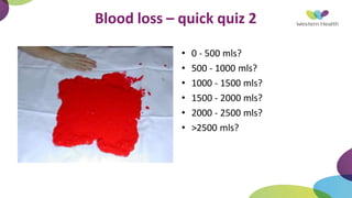 Blood loss – quick quiz 2
• 0 - 500 mls?
• 500 - 1000 mls?
• 1000 - 1500 mls?
• 1500 - 2000 mls?
• 2000 - 2500 mls?
• >2500 mls?
 
